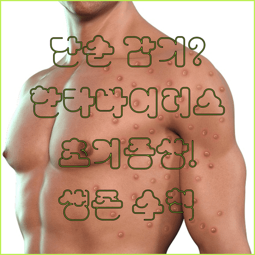 한타바이러스 초기 증상 확인법과 병원 치료 및 예방 수칙